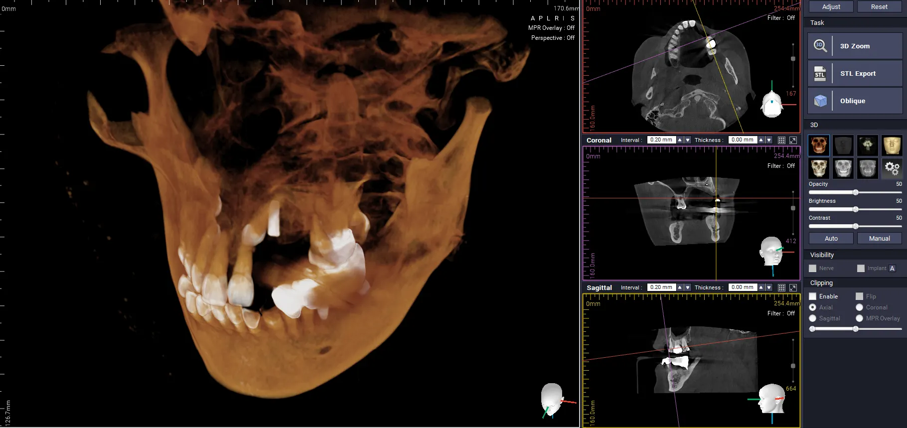3D CT